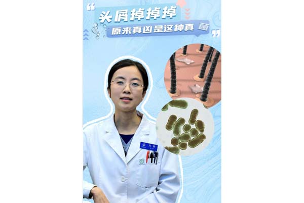 头屑掉掉掉？原来是这个原因……